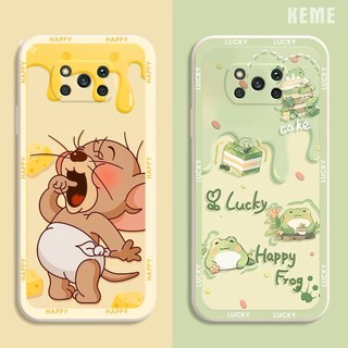 [Viền vuông][Bảo vệ camera] Ốp lưng Xiaomi Poco X3 / X3 NFC / X3 Pro in hình nhà phi hành gia cute dễ thương