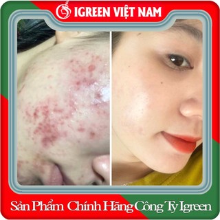 Serum mụn diếp cá - thiên nhiên - cải thiện sau 7 ngày - serum igreen