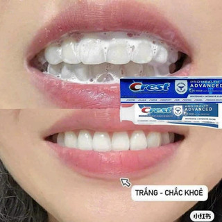 Kem trắng răng Crest 3D Pro Advanced White (bản cải tiến)