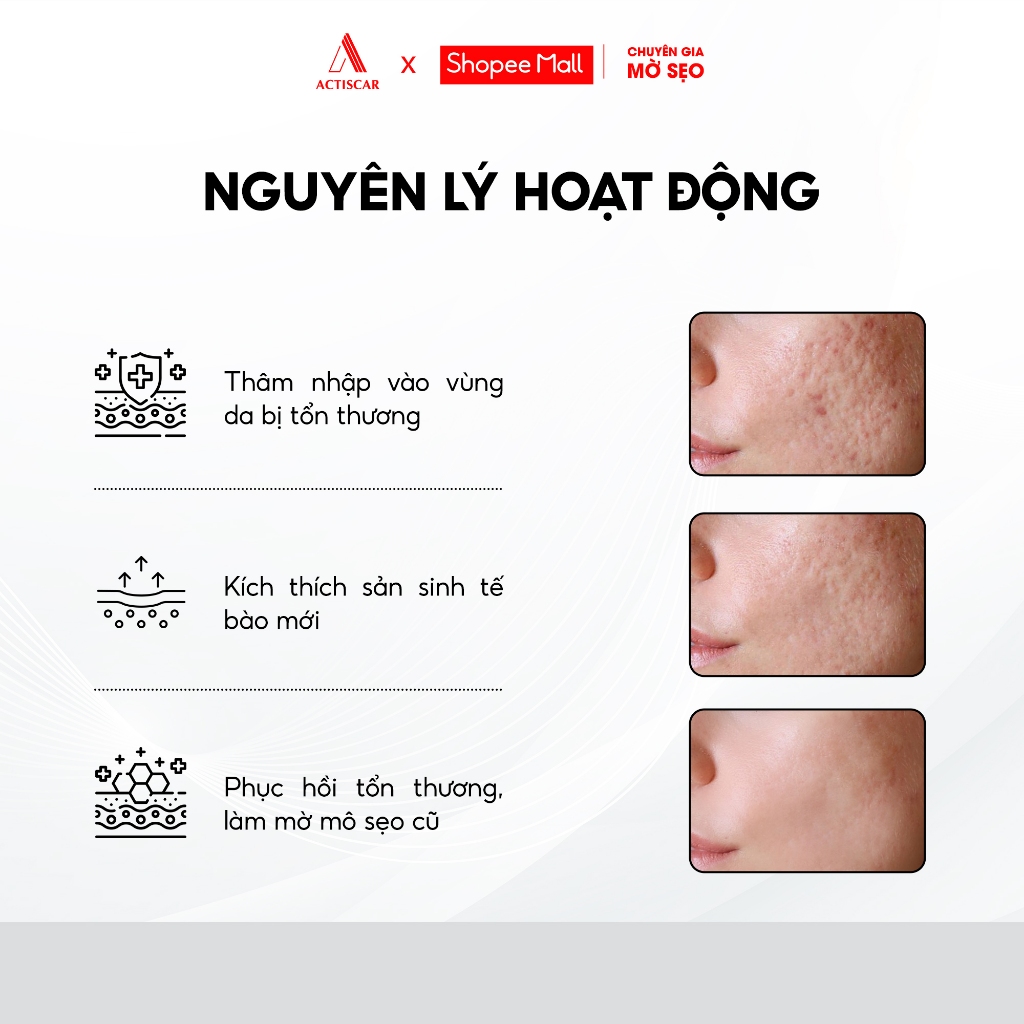 Kem Xoá Mờ Sẹo Actiscar 20g Hỗ Trợ Xóa Mờ Sẹo Lồi, Lõm, Bỏng Bô, Thủy Đậu