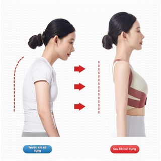 Đai Bảo Vệ Vòng 1 Chống Gù Lưng Ngăn Ngừa Thoái Vị Thoái Hóa Điều Chỉnh Dáng