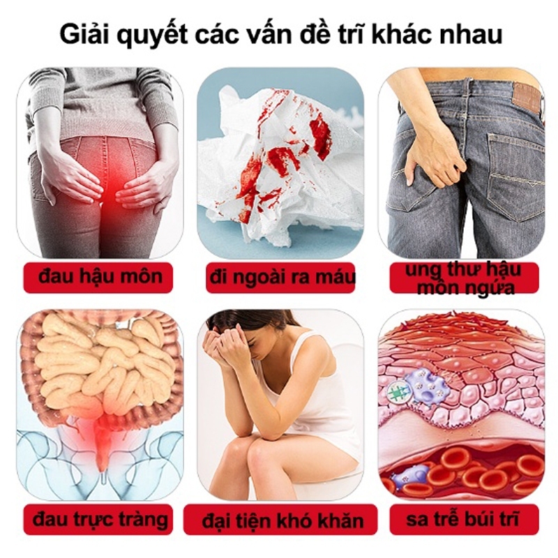 Hot Sale#APGMAZhilike Cold Skin Gel for Men and Women Gel trị bệnh trĩ Kem trị bệnh trĩ cho nam nữ