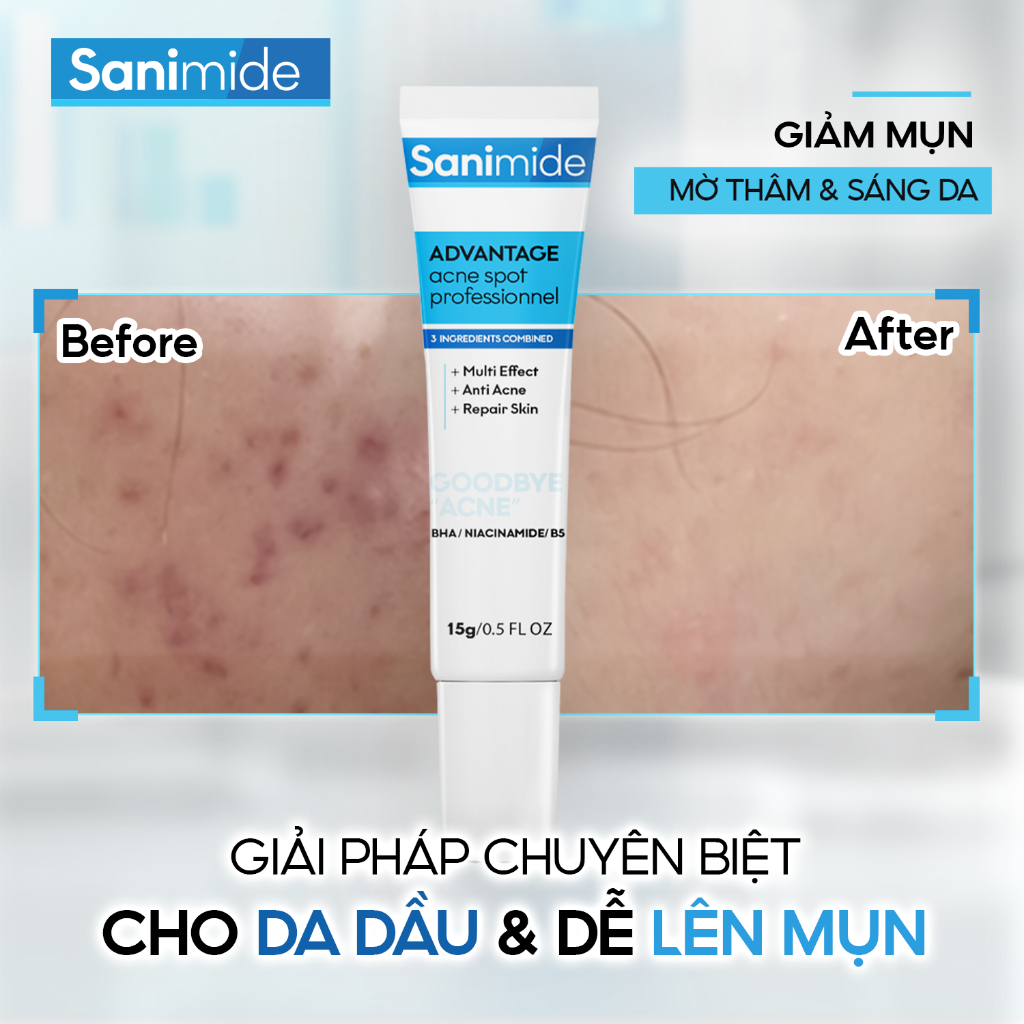 Gel Giảm Mụn Bọc, Mụn Mủ, Mụn Trứng Cá, Mụn Viêm, Mụn Đầu Trắng Và Hỗ Trợ Mờ Thâm Sanimide -Tuýp 15g