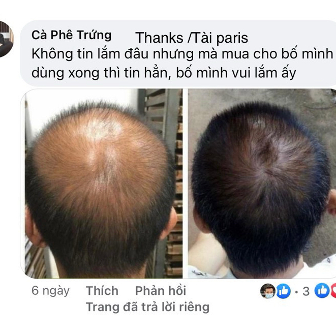 (date 2027) Viên Uống Ngăn Rụng Tóc Kích Thích Mọc Tóc  Arkopharma forcapil Anti-Chute 90 viên