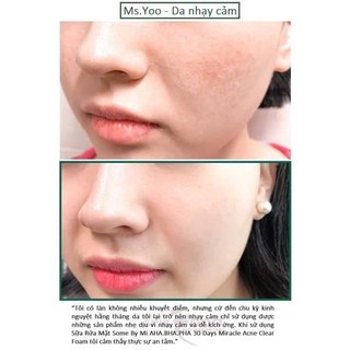 Sữa Rửa Mặt Some By Mi Aha Bha Pha 30 Days