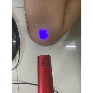 MÁY TRỊ LIỆU LƯỢNG TỬ E-GO TERA - DÒNG CLASSIC