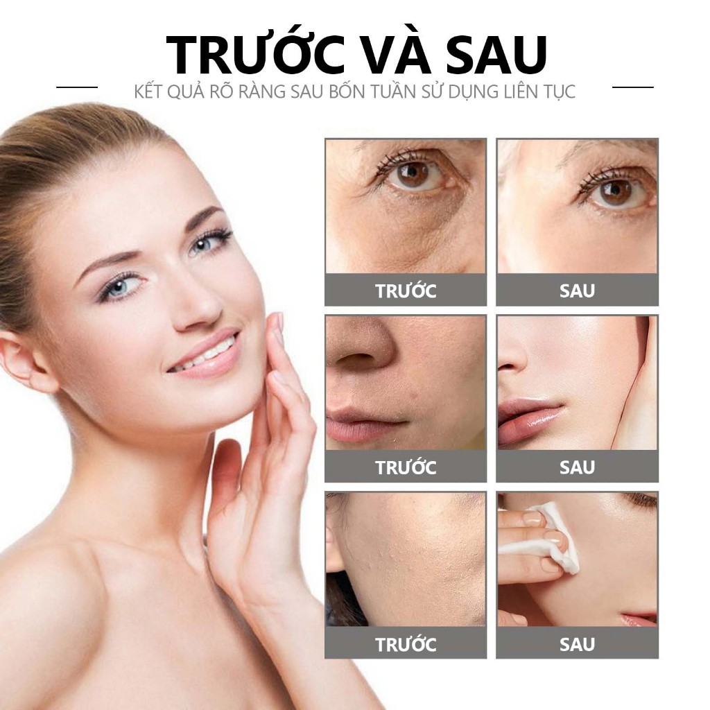 Kem dưỡng ẩm EELHOE giảm nếp nhăn chống khô da dưỡng ẩm làm sáng da ngừa lão hóa 100g