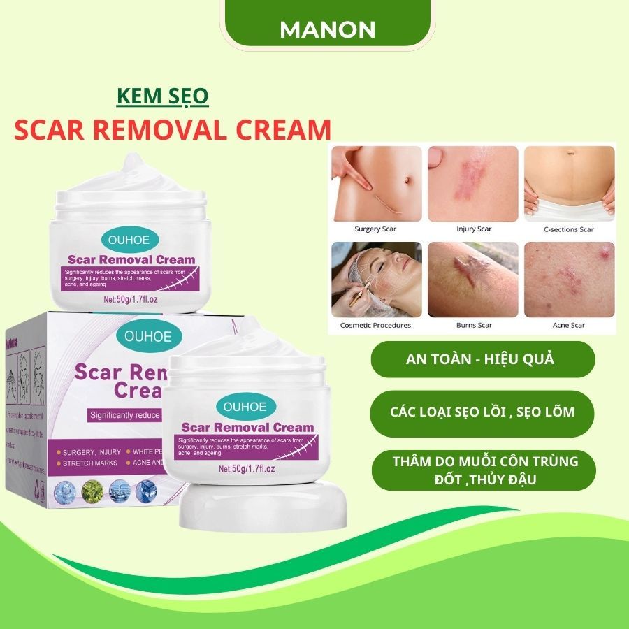 Kem sẹo Scar Removal Cream Kem Xóa Mờ Sẹo Phục Hồi Sẹo Lồi, Lõm, Mờ Vết Thâm Trả Lại Làn Da Mịn Màng