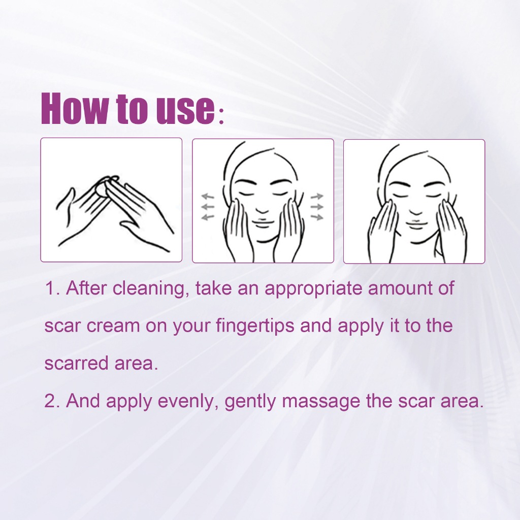 Kem sẹo Scar Removal Cream Kem Xóa Mờ Sẹo Phục Hồi Sẹo Lồi, Lõm, Mờ Vết Thâm Trả Lại Làn Da Mịn Màng
