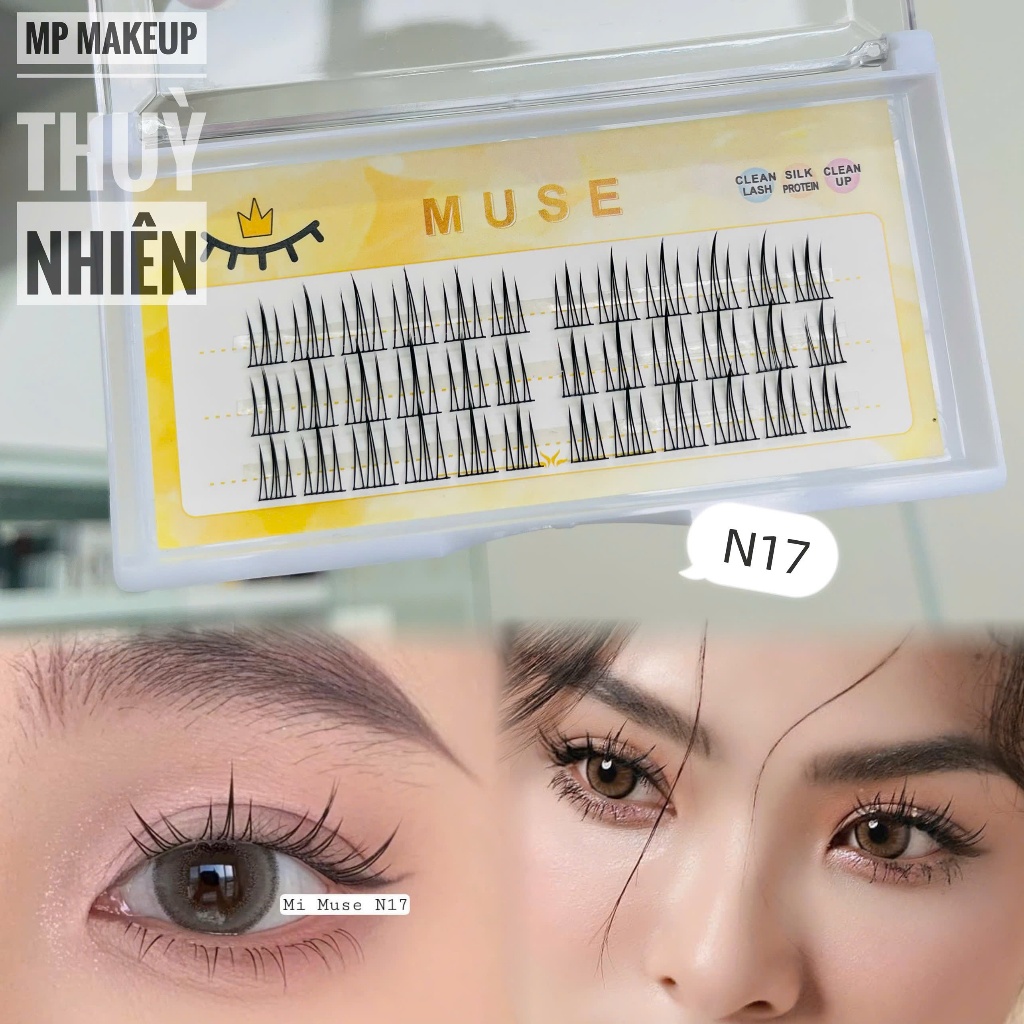 Mi rời tự gắn MUSE - N17 (mi trên)