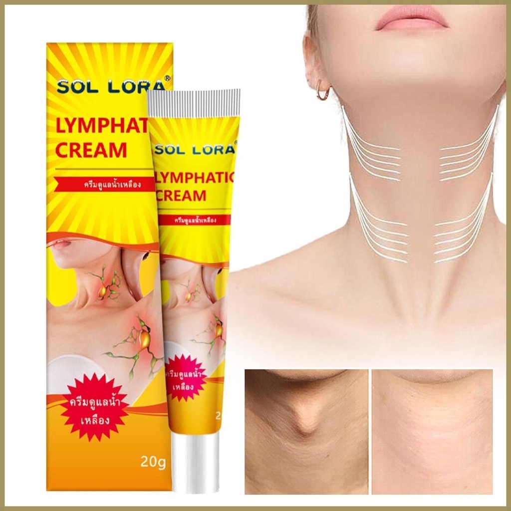 Kem Thảo Dược Tan Hạch Sol Lora - Kem Sol Lora Tiêu Hạch, U Mỡ, Hạch Bạch Huyết, U Bã Đậu Hiệu Quả