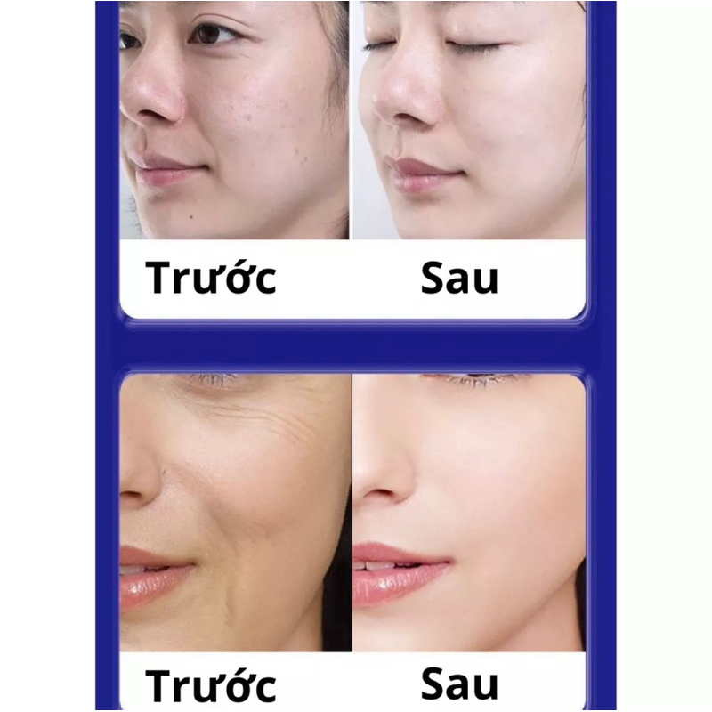 Kem Chống Lão Hóa Trắng Da UCM Nhật Bản - Kem UCM Hút Nhăn Mờ Thâm Nám, Trẻ Hóa Làn Da Nhật Bản