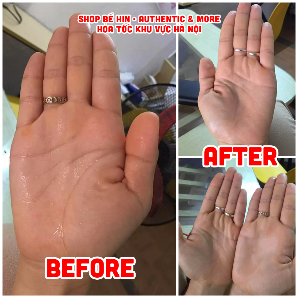 vn 11134207 7r98o lze7gjbl3ln188