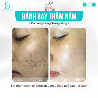 Tế bào gốc nám, trắng sáng Dr Pluscell