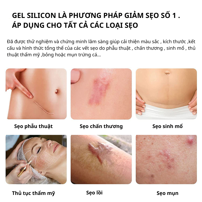 Kem Xóa Sạch Sẹo Thâm, Kem Sẹo ASMOXA lấp đầy Sẹo Rỗ, Sẹo Lõm Phục Hồi Vết Thương Xóa Sẹo Và Phục Hồi Tổn Thương Da 30g