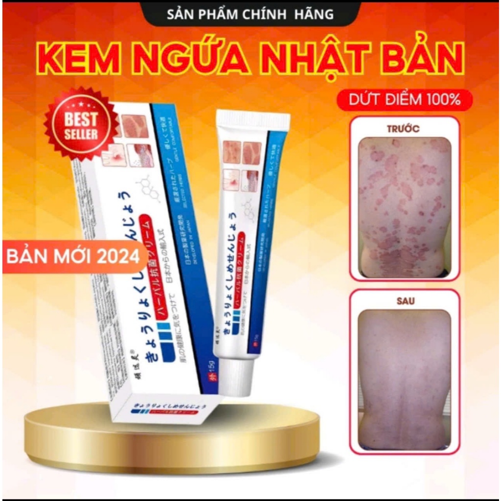 Kem Bôi Viêm Da Cơ Địa NHẬT BẢN Hỗ Trợ Dứt Điểm Lác Đồng Tiền, Nấm Da Đầu, Ghẻ Nước, Á Sừng Cực Kì Hiệu Quả