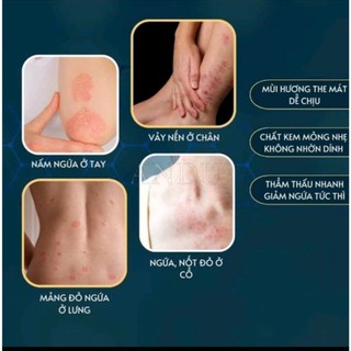 Kem Bôi Viêm Da Cơ Địa NHẬT BẢN Hỗ Trợ Dứt Điểm Lác Đồng Tiền, Nấm Da Đầu, Ghẻ Nước, Á Sừng Cực Kì Hiệu Quả