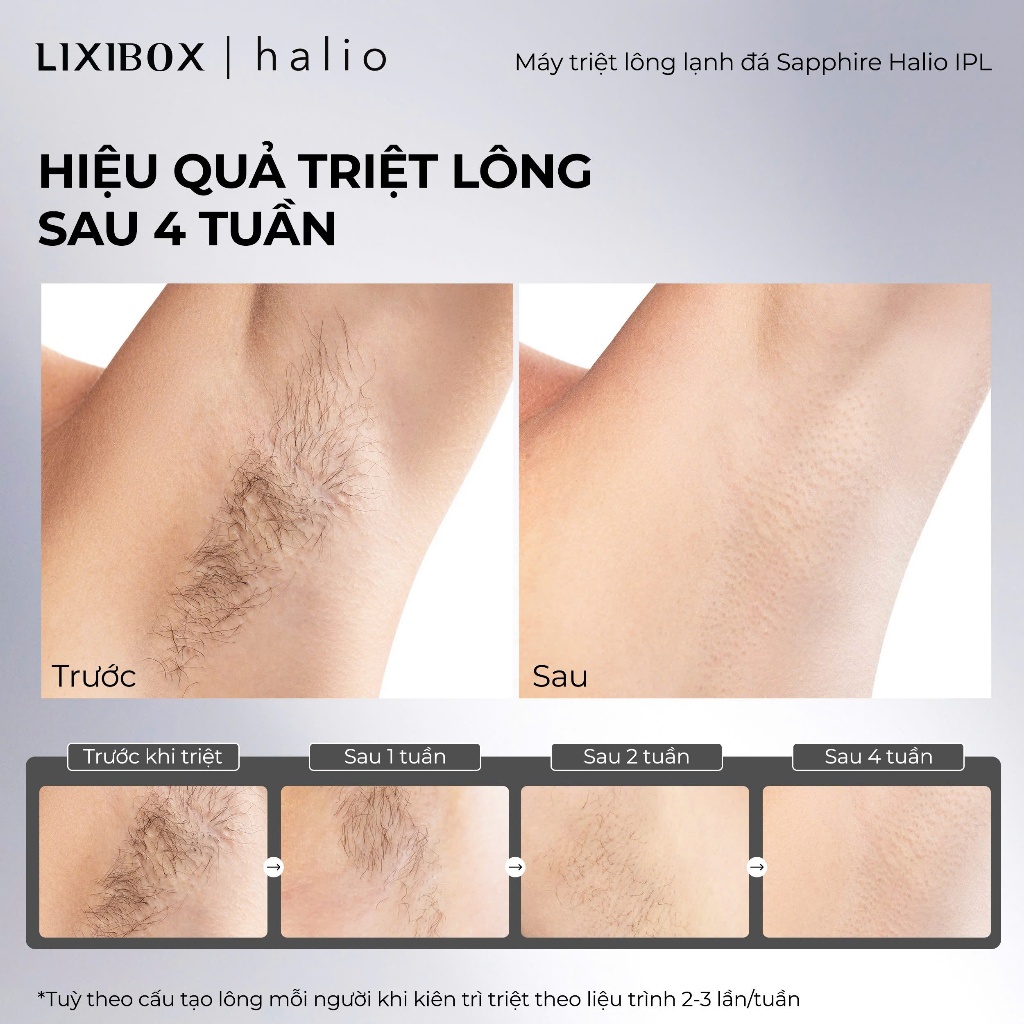 Máy Triệt Lông Lạnh Sapphire Halio InfinityGlow Advanced IPL Sapphire Cooling Hair Removal Device | BigBuy360 - bigbuy360.vn