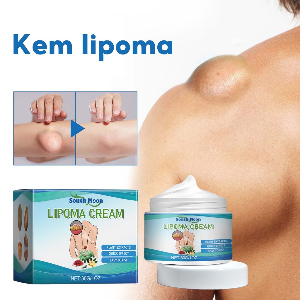 South Moon Kem loại bỏ u mỡ tan u mỡ Kem lipoma Loại bỏ mỡ dưới da Làm thông thoáng các cục mỡ 30g