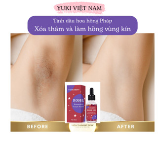 Serum giảm thâm nách hoa hồng 30ml, giảm thâm vùng kín, vùng nách, đầu gối, LÀM HỒNG cô bé và nhũ hoa
