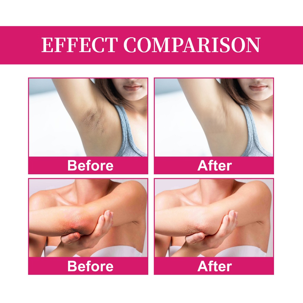 Kem làm trắng da OUHOE dưỡng ẩm sáng da giảm sắc tố đen vùng nách và khu vực nhạy cảm 60ml