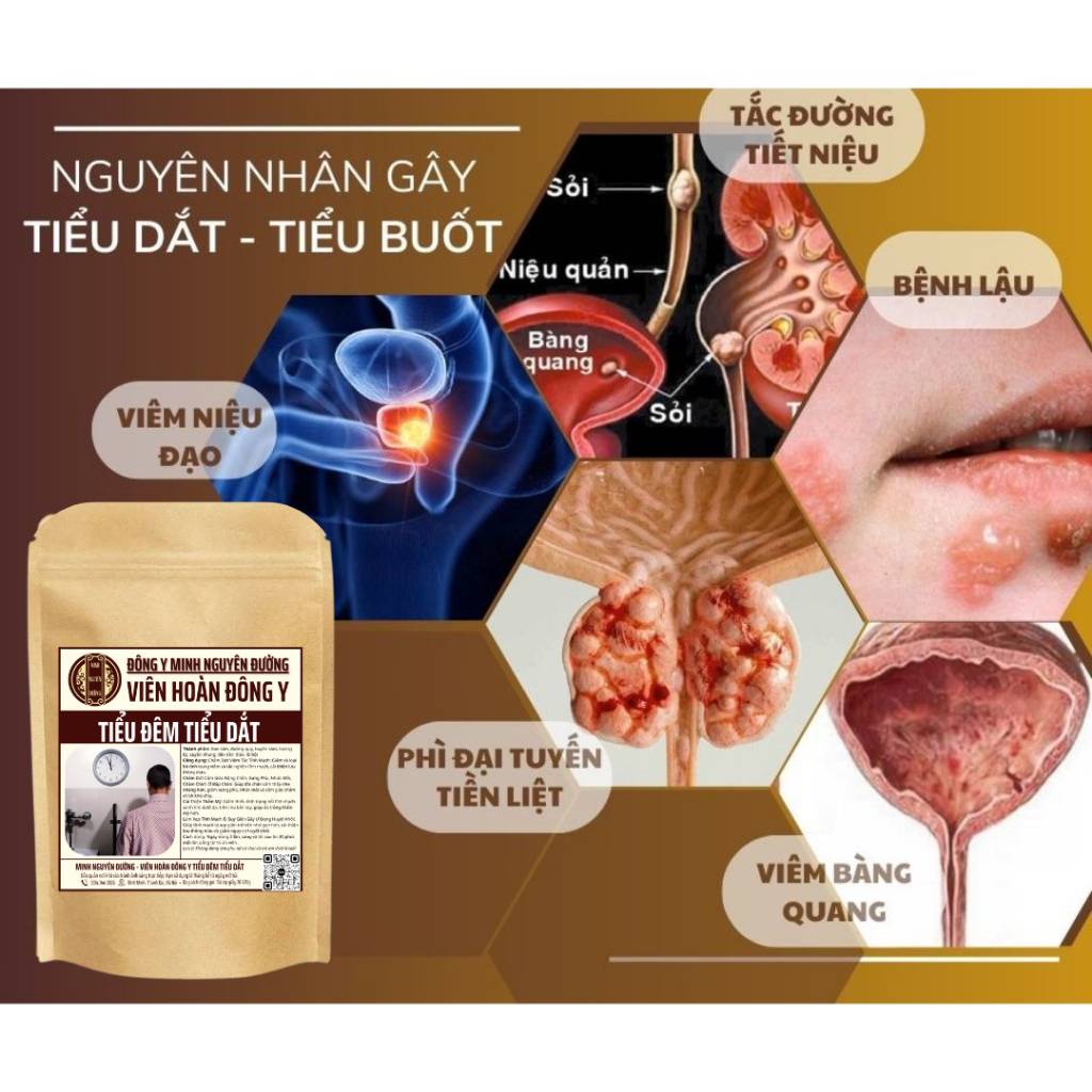 Viên tiểu đêm tiểu dắt Minh Nguyên đường giảm tình trạng tiểu són, tiểu buốt, tức bọng tiểu hiệu quả