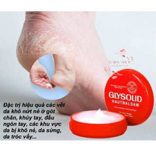 Kem nẻ Glysolid Hautbalsam, dưỡng da chuyên sâu 100 ml của Đức