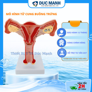Mô hình giải phẫu tử cung, mô hình tử cung buồng trứng, mô hình phụ khoa