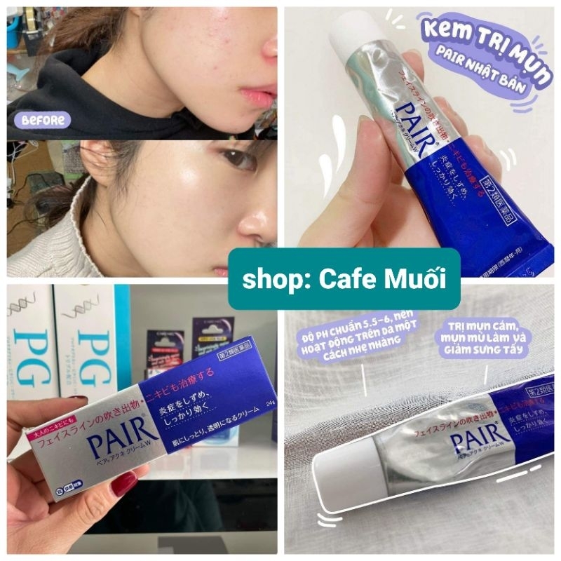 KEM GIẢM MỤN Lion Pair Acne Cream W 24g