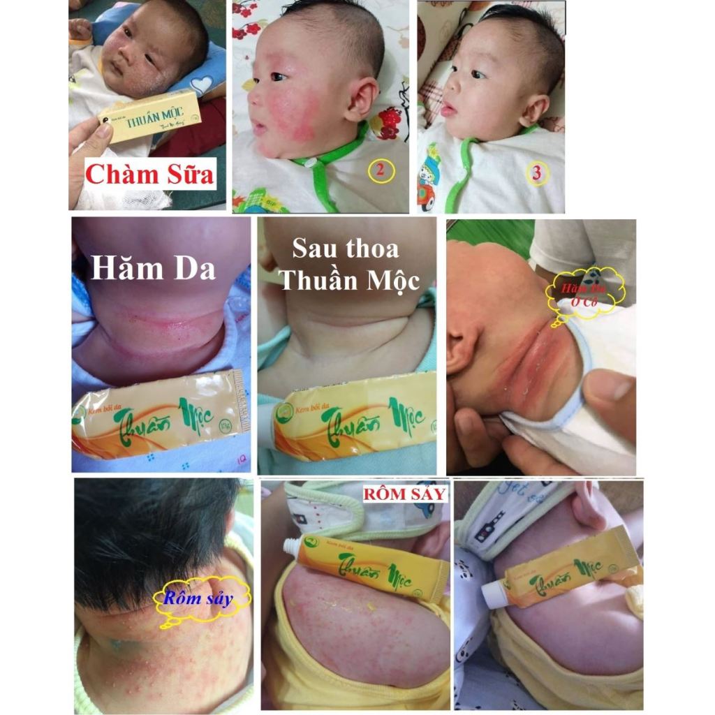 kem bôi da thuần 16g mộc chính hãng