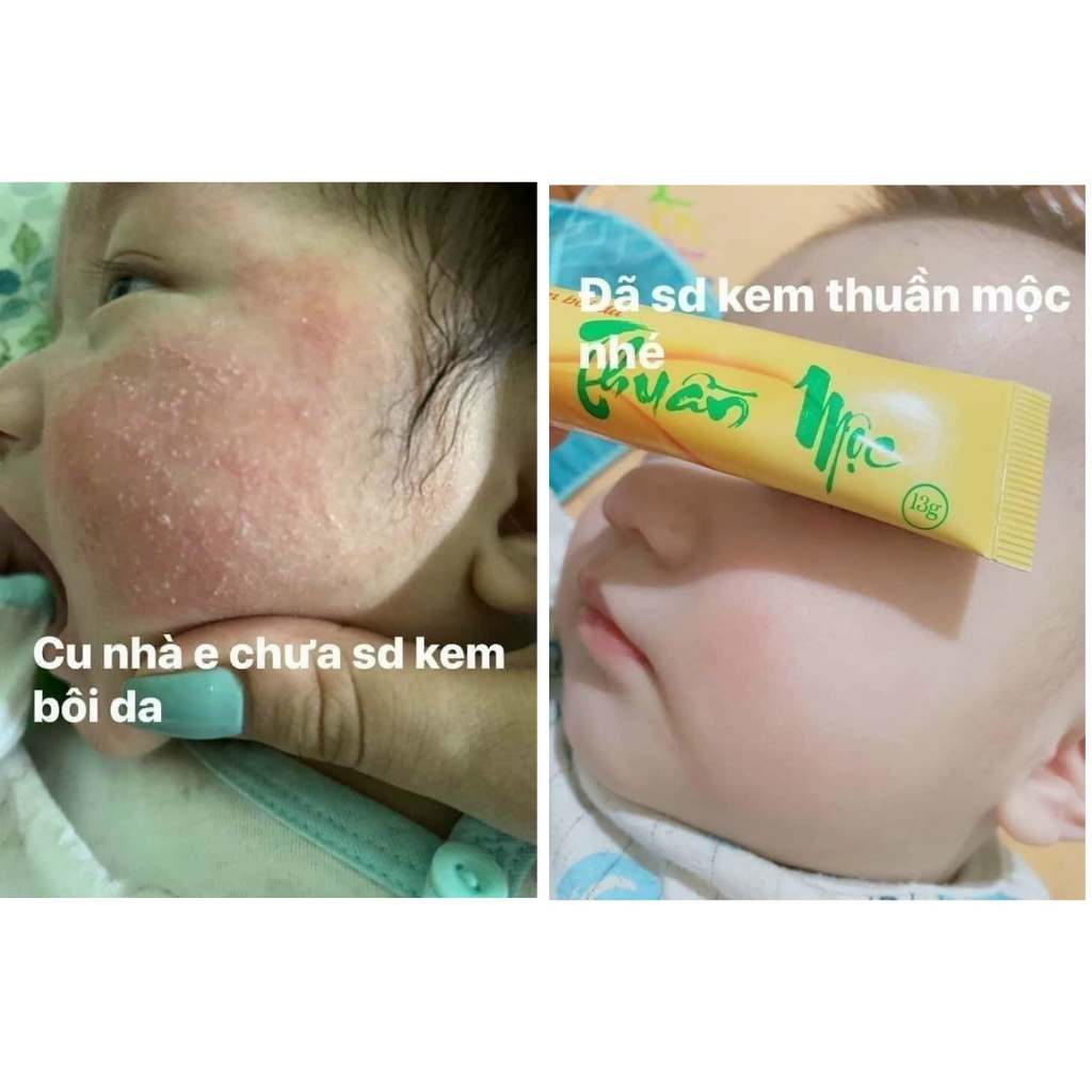 kem bôi da thuần 16g mộc chính hãng