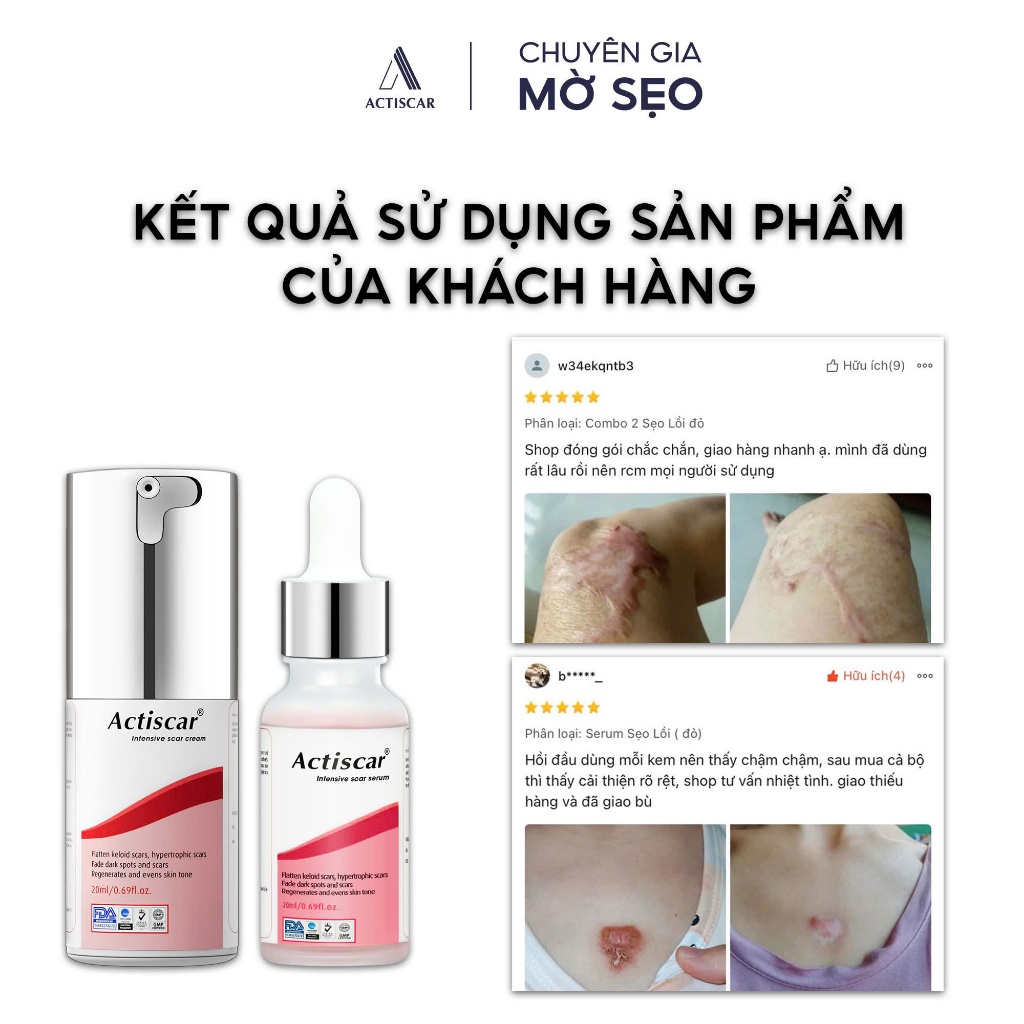 Kem Mờ Sẹo Lồi To, Sẹo Phì Đại Actiscar Hỗ Trợ Làm Mềm Sẹo, Phẳng Sẹo Và Giảm Thâm