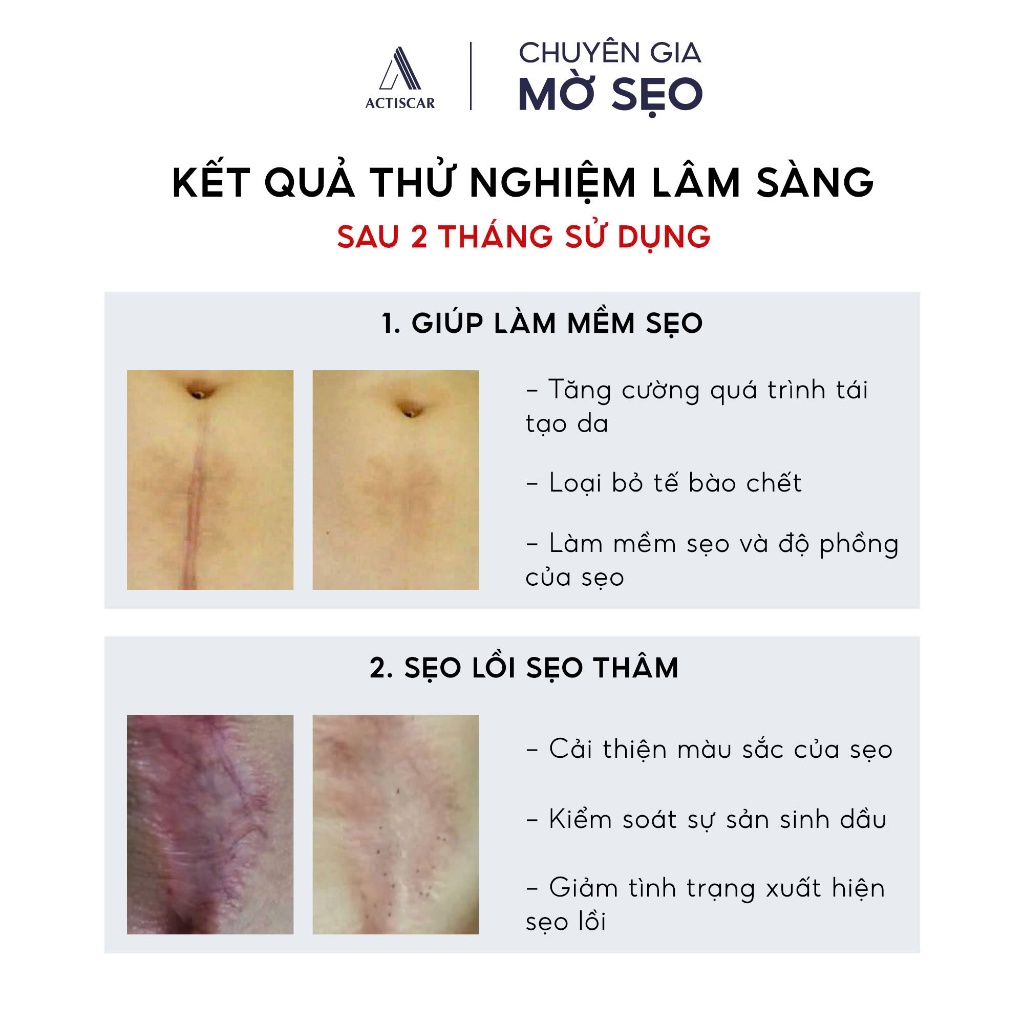 Kem Mờ Sẹo Lồi To, Sẹo Phì Đại Actiscar Hỗ Trợ Làm Mềm Sẹo, Phẳng Sẹo Và Giảm Thâm