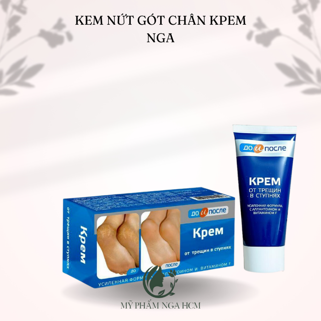 Kem giảm nứt gót chân Kpem Nga
