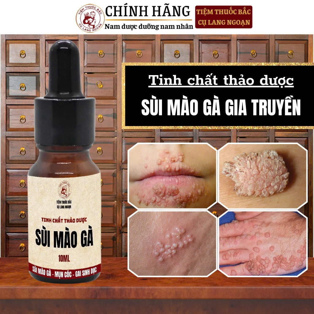 [Rụng sùi dứt điểm] Tinh chất chấm sùi mào gà Cụ Lang Ngoạn làm nhanh khô rụng sùi, mụn cóc, tránh tái lại lọ 10ml
