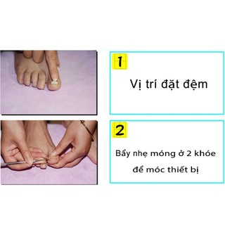 Bộ dụng cụ hỗ trợ chữa trị quặp móng chân móng chân chọc vào thịt gây đau đớn (LOẠI TỐT NHẤT)