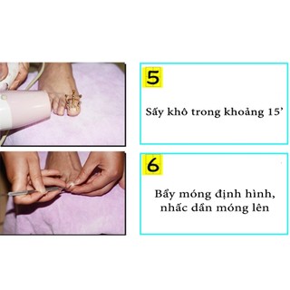 Bộ dụng cụ hỗ trợ chữa trị quặp móng chân móng chân chọc vào thịt gây đau đớn (LOẠI TỐT NHẤT)