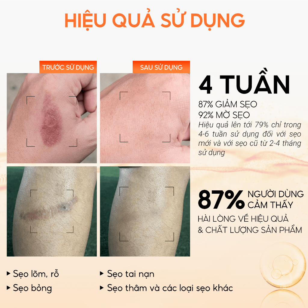 Kem Nghệ Đỏ Abera Scar 20g Liền Sẹo - Hỗ Trợ Làm Mờ Sẹo, Giảm Sẹo Lồi, Sẹo Rỗ, Sẹo Thâm,Sẹo Tai Nạn Do ĐHBK HÀ NỘI NC