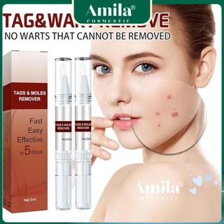 🌟 Tags & Moles Remover - Giải Pháp Tối Ưu Loại Bỏ Mụn Cóc & Nốt Ruồi 🌟