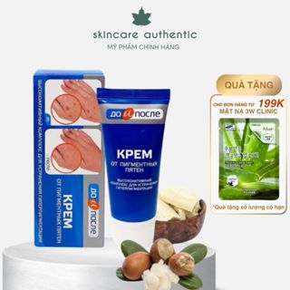 Kem Đồi Mồi Tay Chân Kpem Nga, Giảm Gân Tay, Chống Lão Hóa, Dưỡng Da Tay