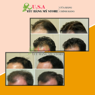 Combo Mọc Râu Tóc Dạng Bọt KIRK-LAND - Biotin