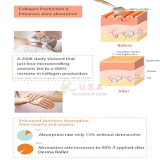 Lăn Kim ZGTS 192 Micro Needles Derma Roller 0.5mm