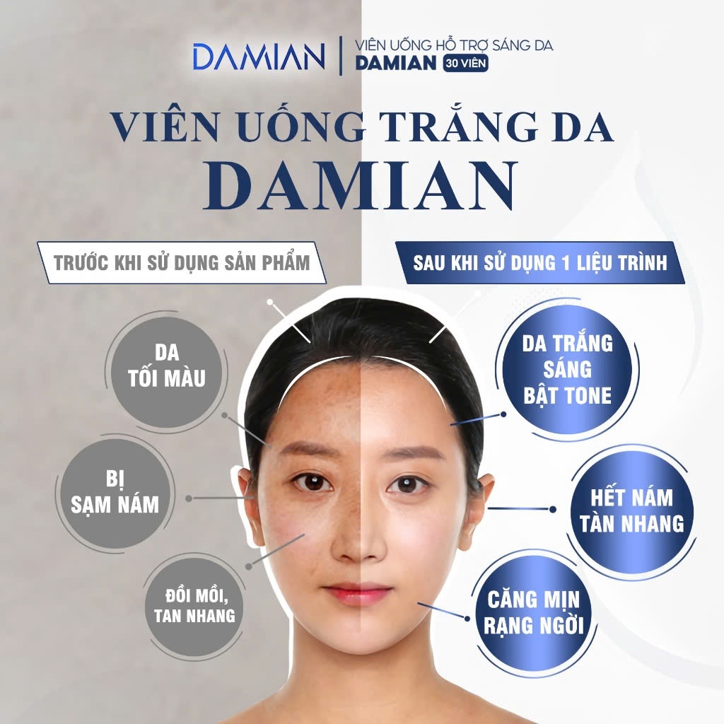 DAMIAN Viên Uống Trắng Da Chứa Glutathione Giúp Trắng Da, Căng Bóng, Mờ Thâm Nám, Hết Tàn Nhang, Sau 1 Liệu Trình