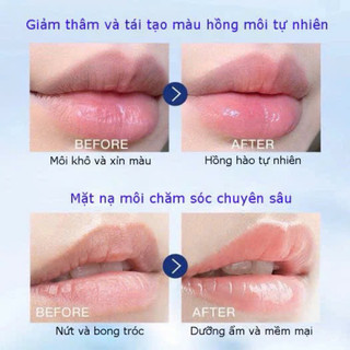 Dưỡng Môi Vaseline Lip Therapy, Son Dưỡng Môi Vaseline
