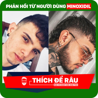 Minoxidil 5% Dạng Bọt Mọc Râu Tóc Kirkland Mỹ