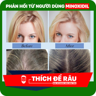 Lăn Kim ZGTS 192 Micro Needles Derma Roller 0.5mm
