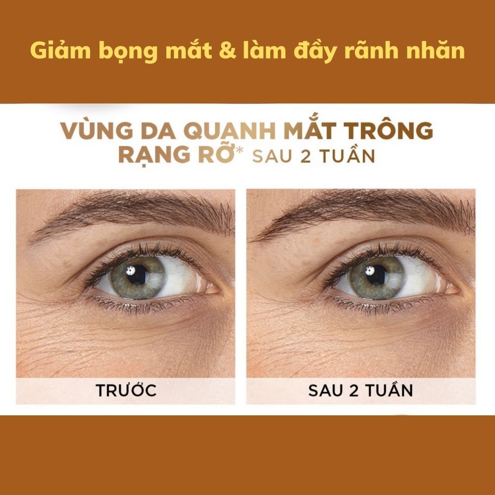 Kem Dưỡng Mắt OSUFI, Kem Mắt Hỗ Trợ Làm Sáng Da, Mờ Quầng Thâm, Bọng Mắt, Ngăn Ngừa Nếp Nhăn Lão Hoá OSUFI