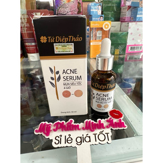 Serum mụn 4h tứ diệp thảo 30ml (chuẩn cty)