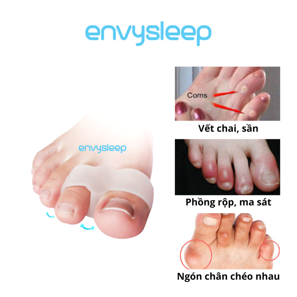 Silicon ENVYSLEEP giảm đau 2 ngón chân với giày búp bê, giày bít,1 bộ 2 cái, free size, nam và nữ