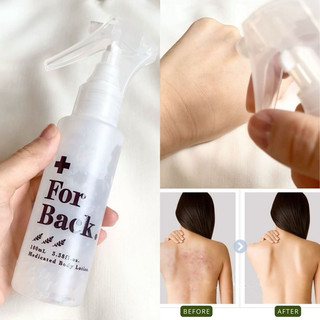 Xịt Giảm Mụn Lưng For Back